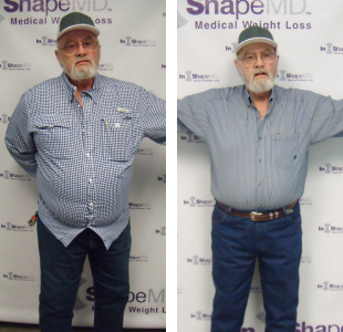Before and after weight loss pictures of a man with a white beard