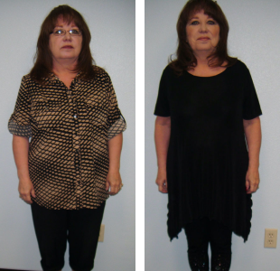 Before and after weight loss pictures of an older woman