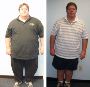 Before and after weight loss images of a man