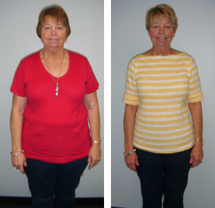 Before and after weight loss pictures of a woman with short hair