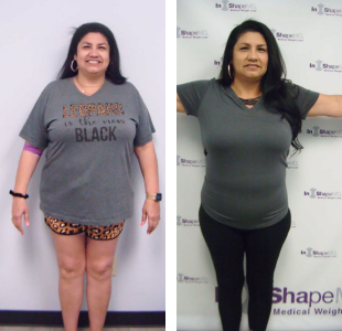 Before and after weight loss pictures of a woman wearing gray
