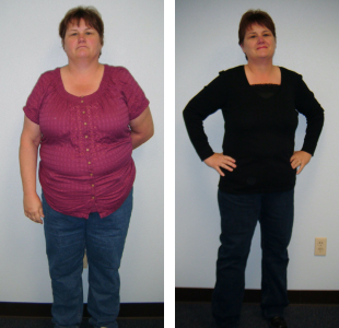 A woman’s before and after weight loss pictures